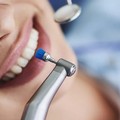 Igiene orale: perché le visite di controllo restano importanti dopo cure canalari e devitalizzazioni